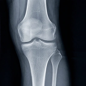 Orthopedics